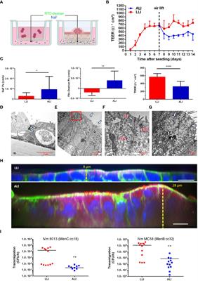 Interaction of Neisseria meningitidis carrier and disease isolates of MenB cc32 and MenW cc22 with epithelial cells of the nasopharyngeal barrier